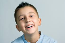 When Should Children Start Orthodontic Treatment?