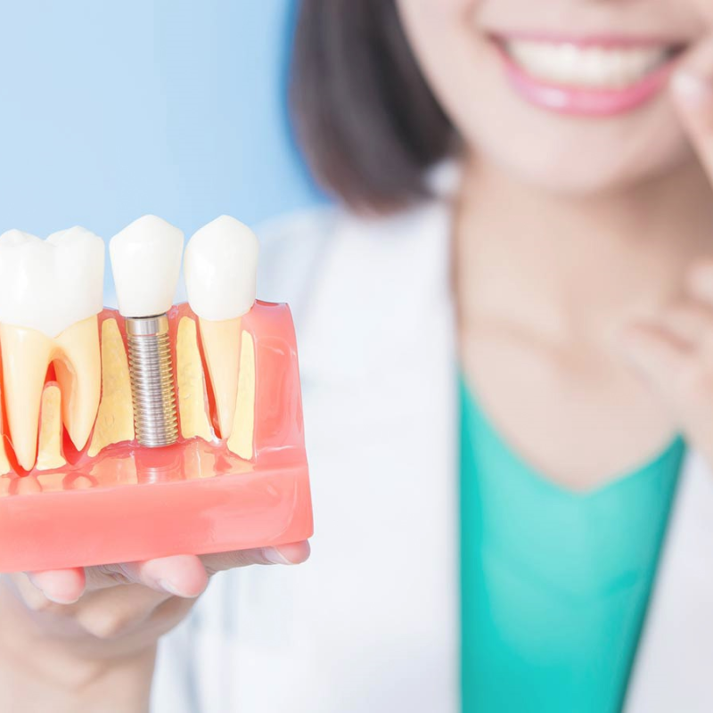 Implantatbehandlung